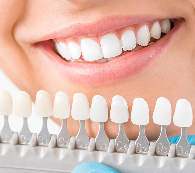 teeth whitening procedures Ventura County