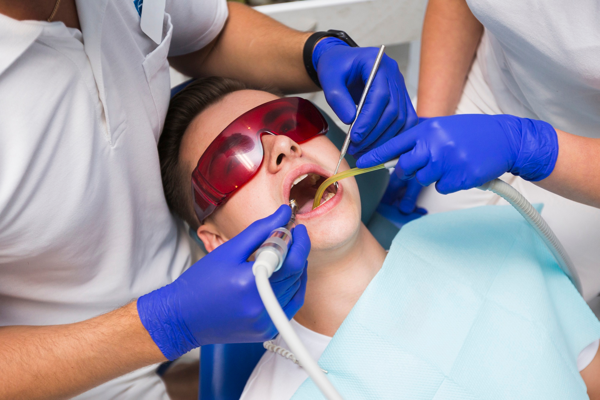Demystifying the Root Canal Procedure – Puri Dentistry Oxnard