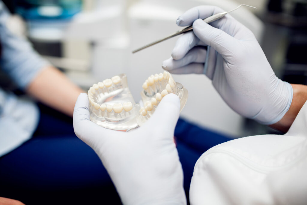 Tooth Bridges in Oxnard: How 3D Printing Is Changing the Way We Restore Smiles