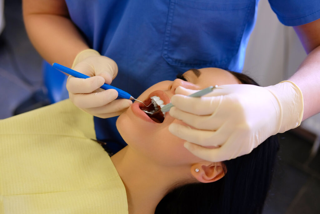 Dental Scaling and Root Planing