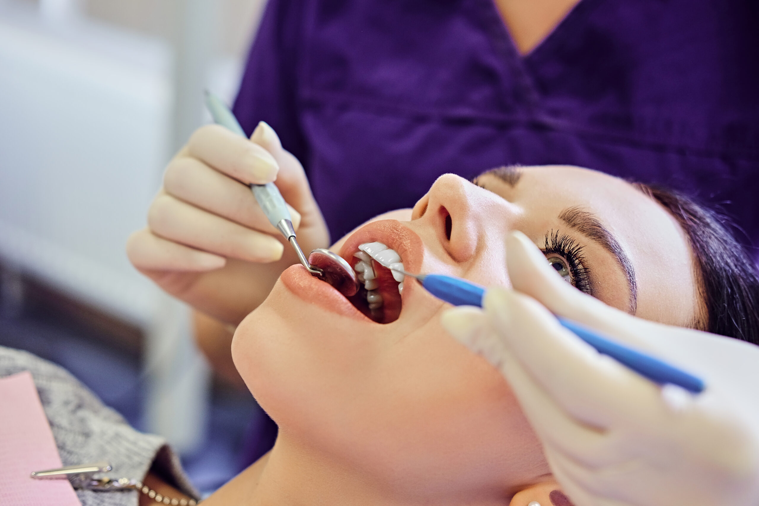 dental fillings in Oxnard
