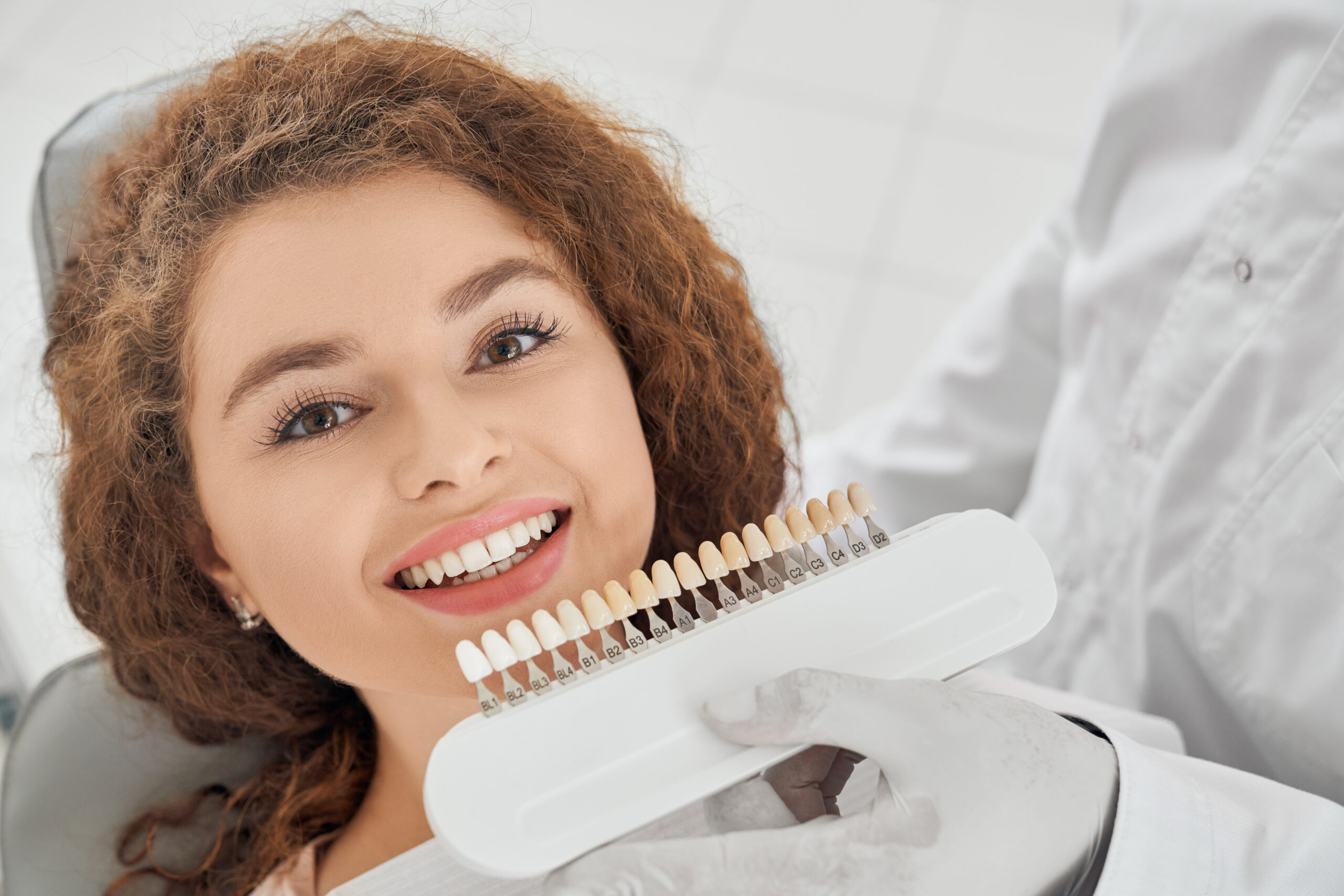 dental veneers in oxnard