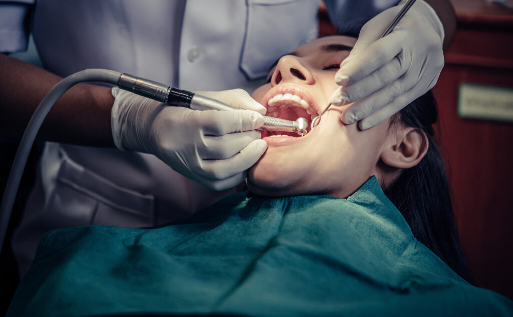 wisdom teeth removal