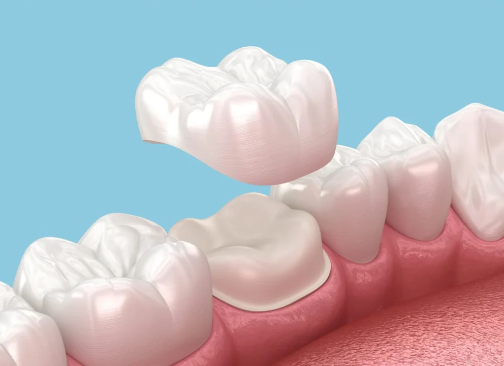 tooth crown