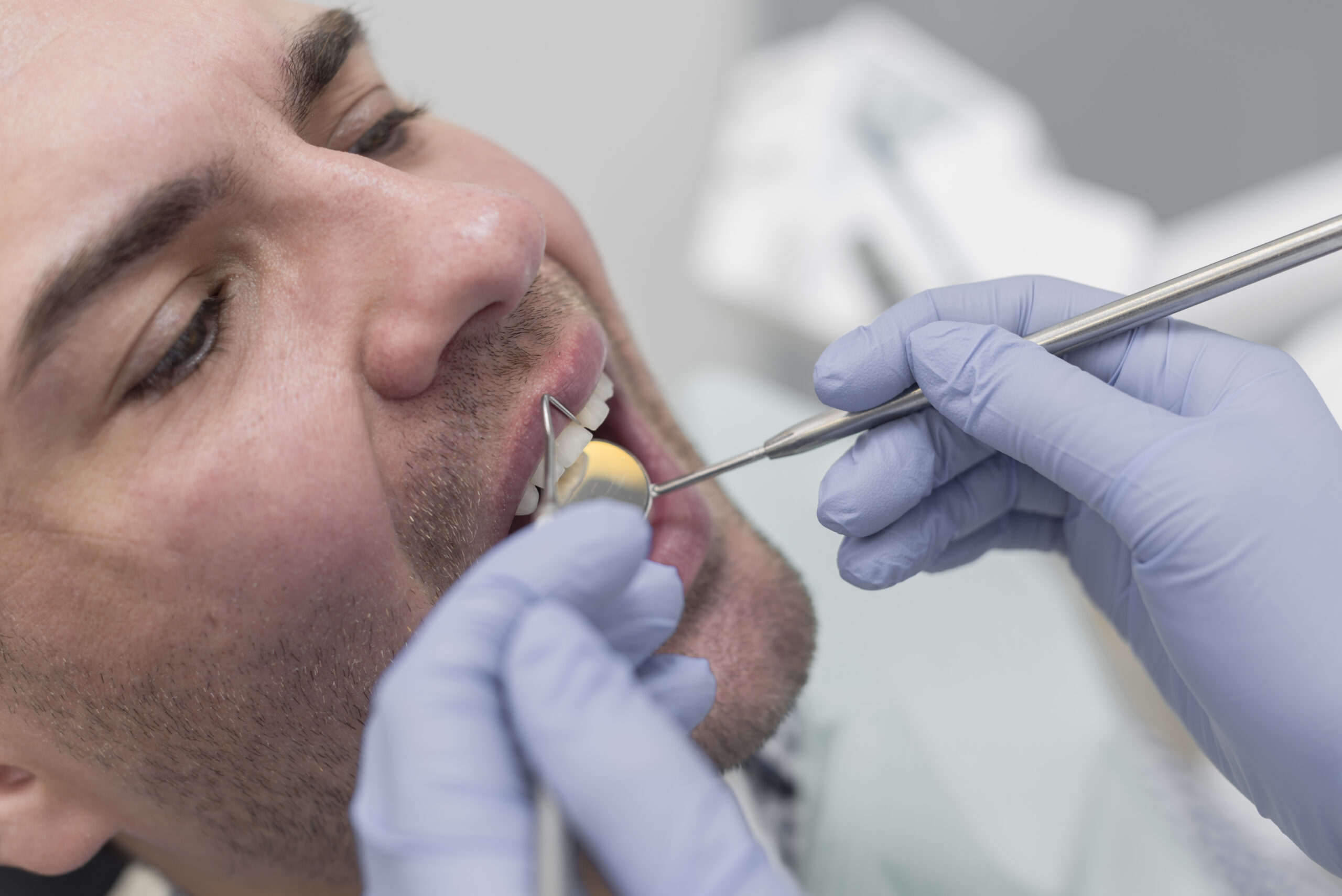 Mercury in Dental Fillings