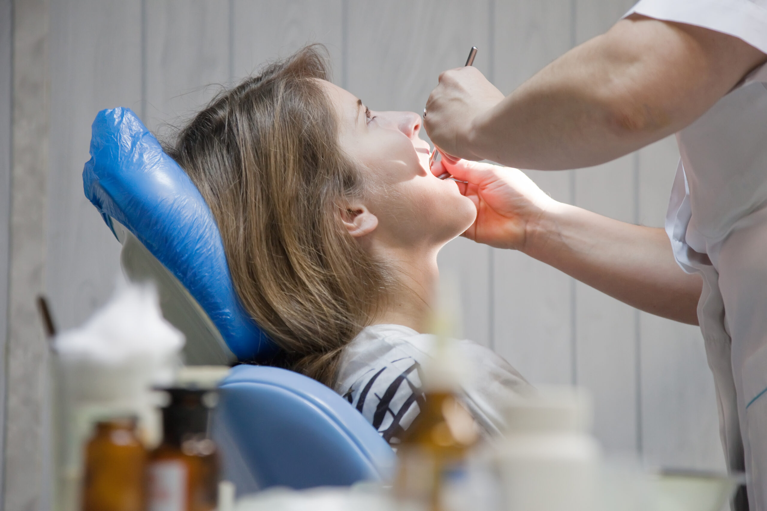 fluoride treatment