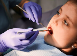dental fillings