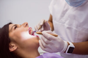 dental fillings